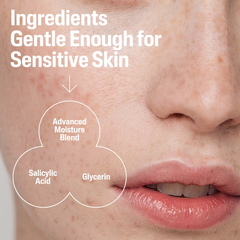 Cetaphil Gentle Clear Salicylic Acid Acne Pore Cleanser - 8 fl oz